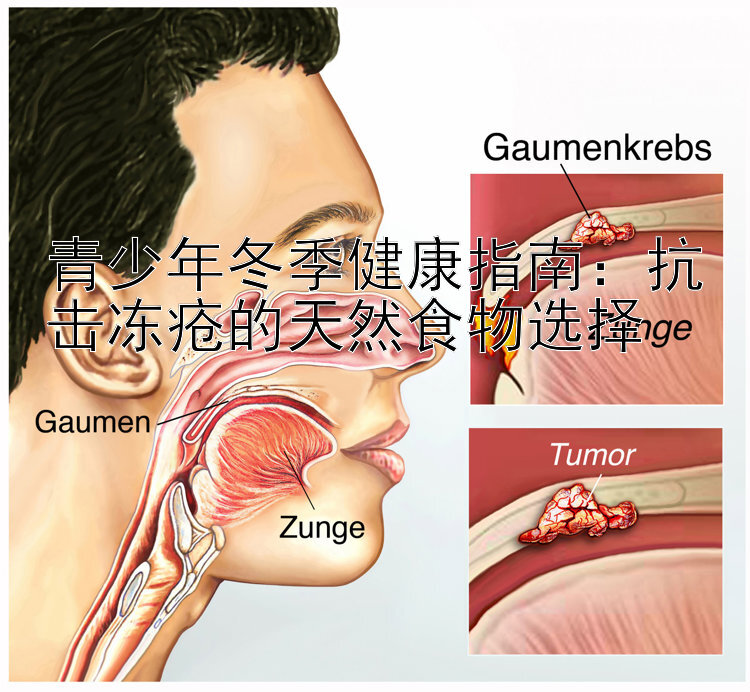 青少年冬季健康指南：抗击冻疮的天然食物选择