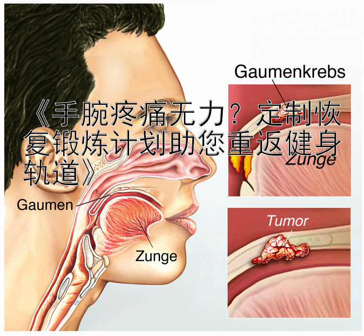 《手腕疼痛无力？定制恢复锻炼计划助您重返健身轨道》